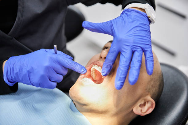 Best Dentist for Tooth Abscess  in Double Oak, TX